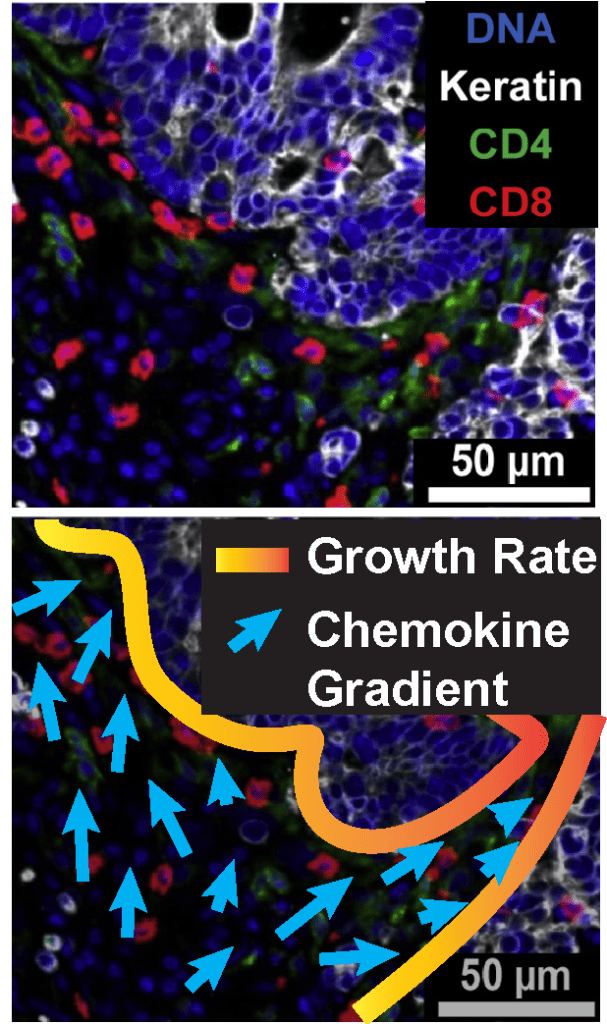 immune system, T-cell, chemotaxis, cytokines, tumor, growth, gradient, immune suppression, cytotoxicity